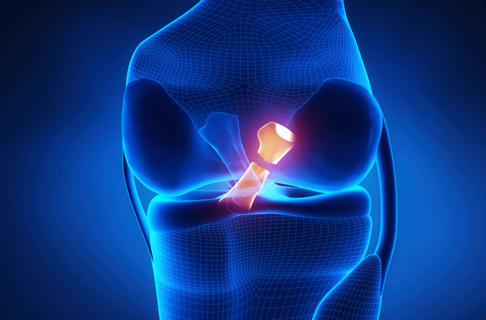 ACL & PCL Meniscus Injuries