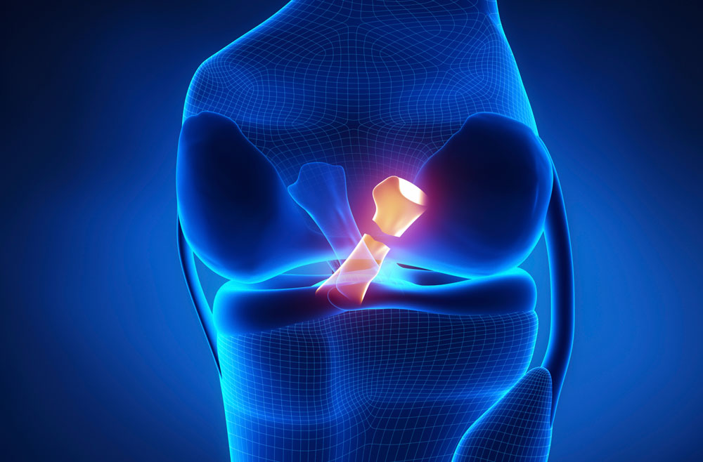 ACL & PCL Meniscus Injuries